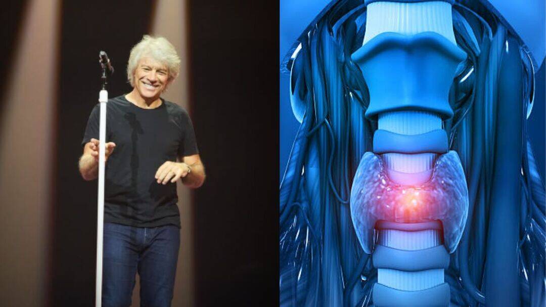 Jon Bon Jovi performs again after major vocal cord surgery