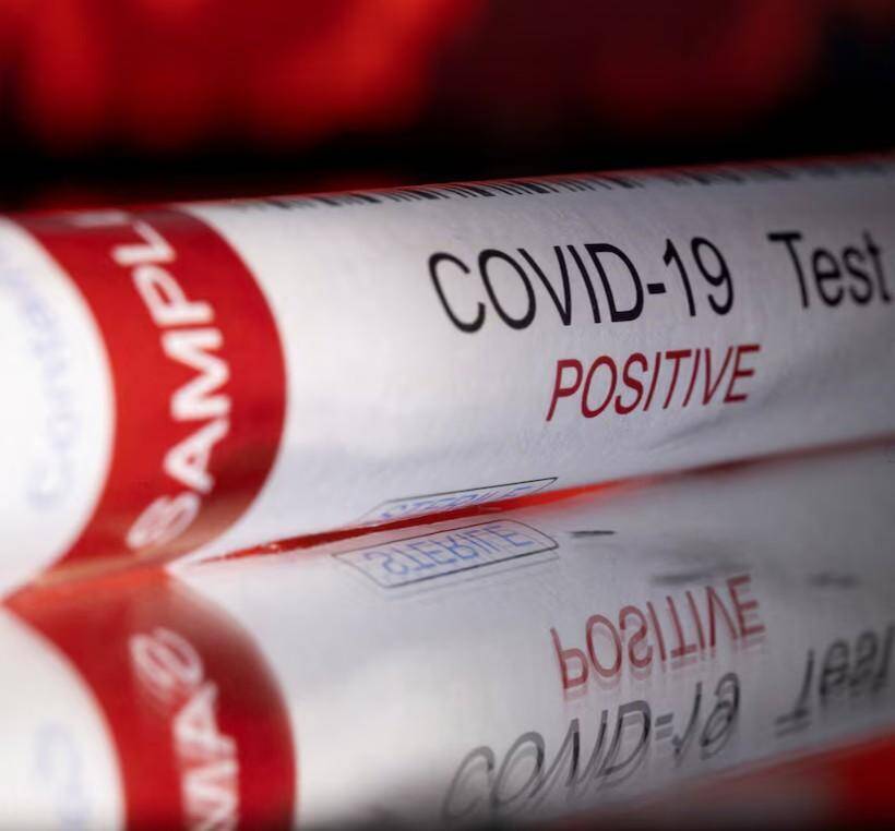 46-yr-old man dies of COVID-19 in Andhra; officials launch contact tracing