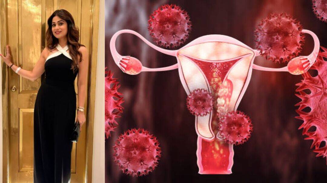 Shamita Shetty opens up on her struggle with endometriosis 
