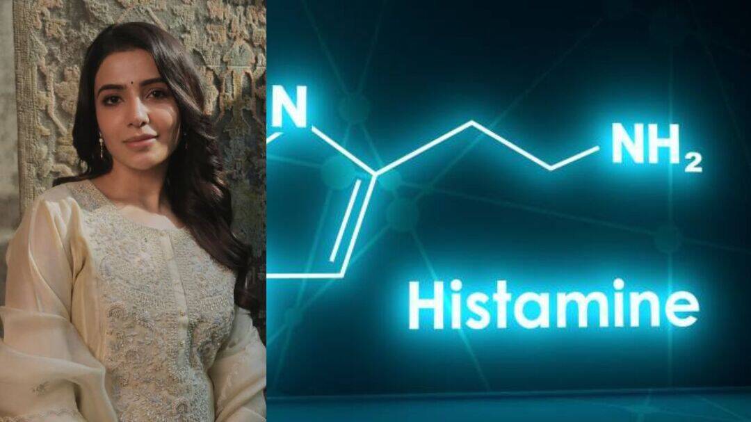 Samantha talks about histamine intolerance and its warning signs