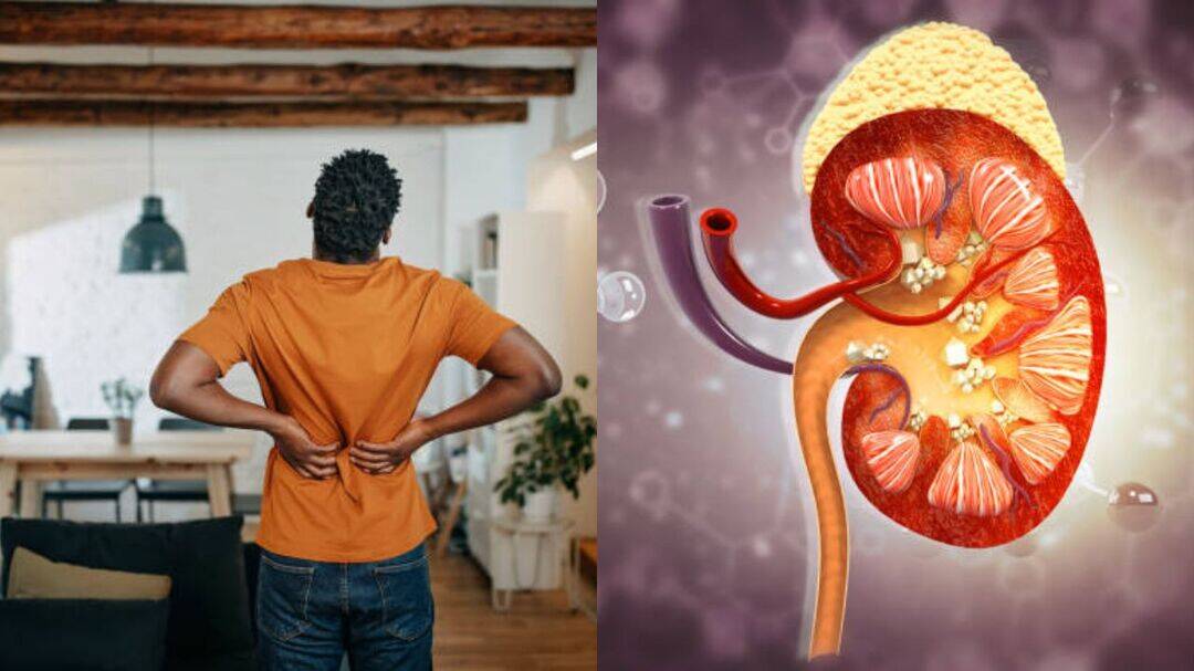 Back pain or kidney stones? 8 warning signs you shouldn't ignore
