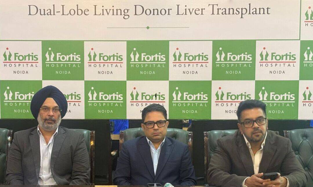 Fortis Noida performs world's first dual-lobe liver transplant