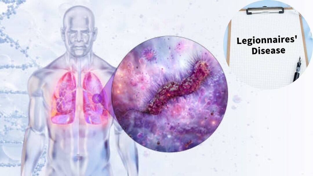 Second death reported in New York Legionnaires' outbreak