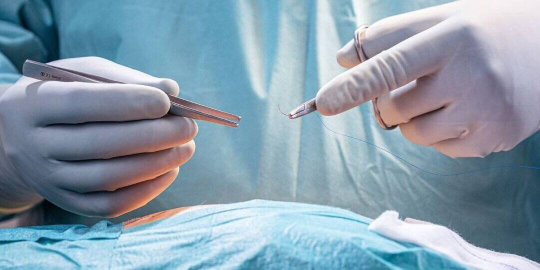 5 women suffer complications after C-sections at T'gana hospital