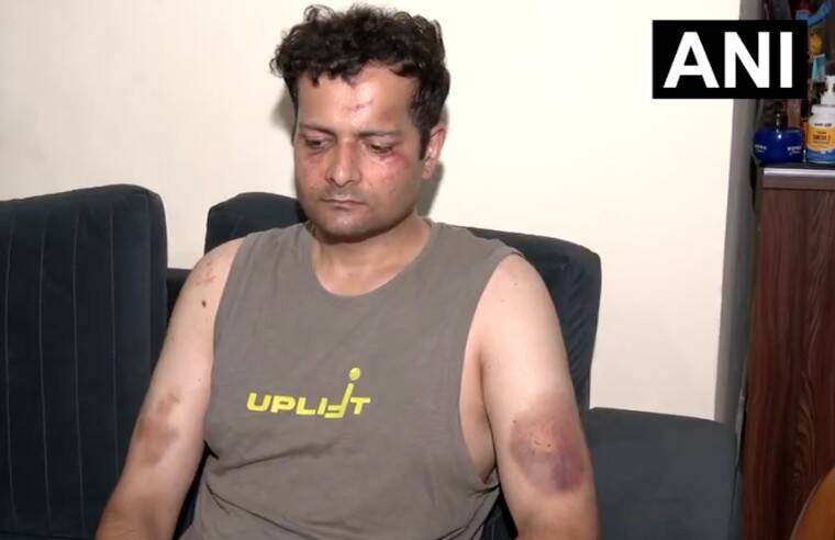 Delhi Police ACP shows his injuries after being beaten by protesters while saving staff member