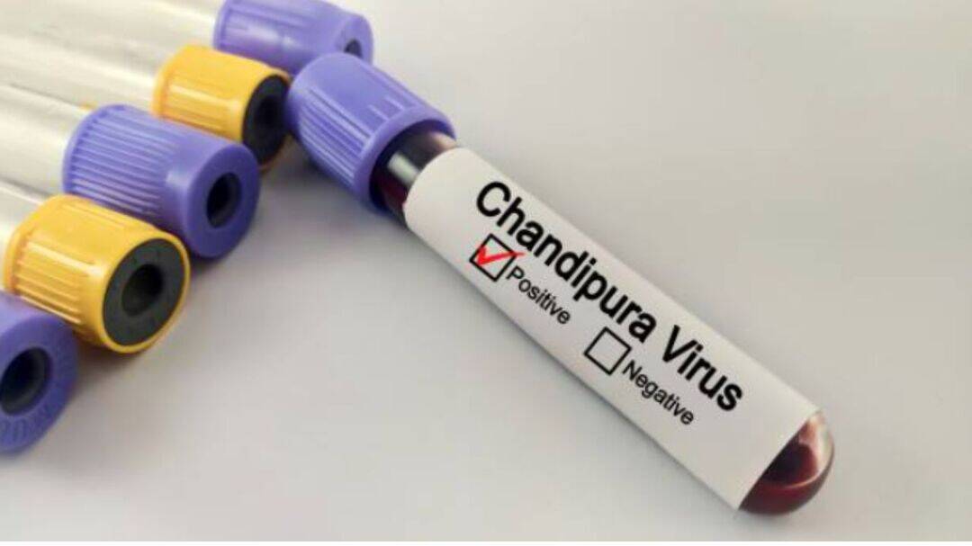 2 die of Chandipura virus in Rajasthan; experts warn of symptoms
