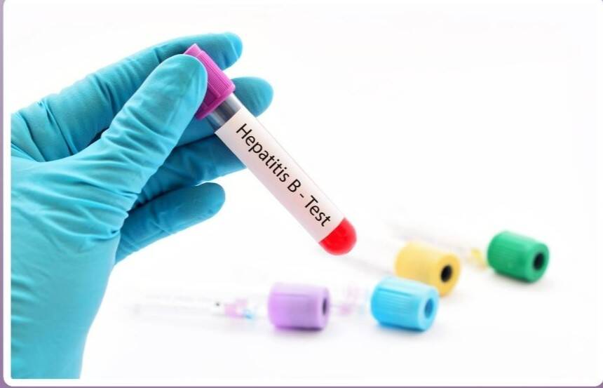Is every case of jaundice a sign of hepatitis?