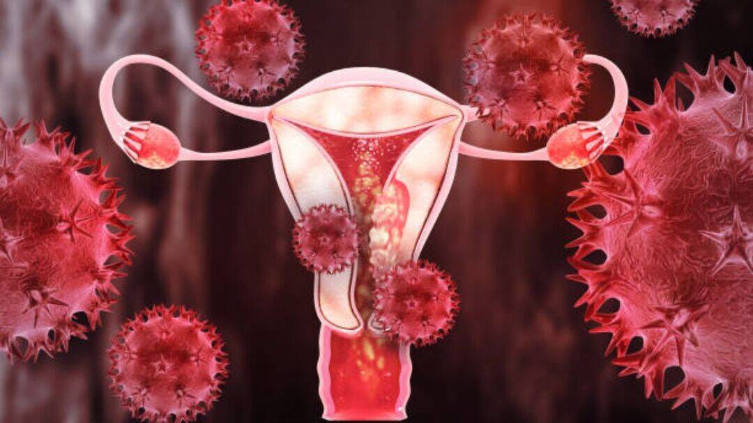 New cervical cancer pill could stop HPV before cancer develops