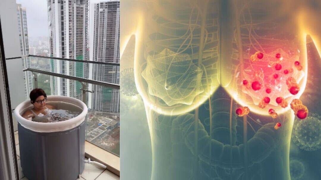 Hina Khan's cryotherapy: Is ice therapy safe after cancer?