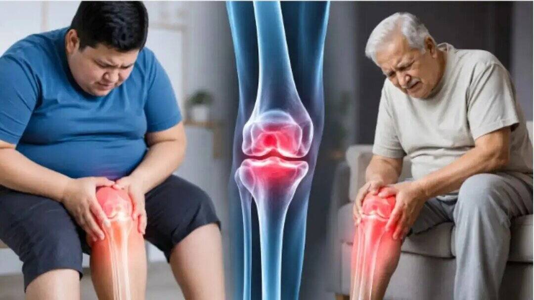 Doctors warn early weight gain may increase arthritis risk