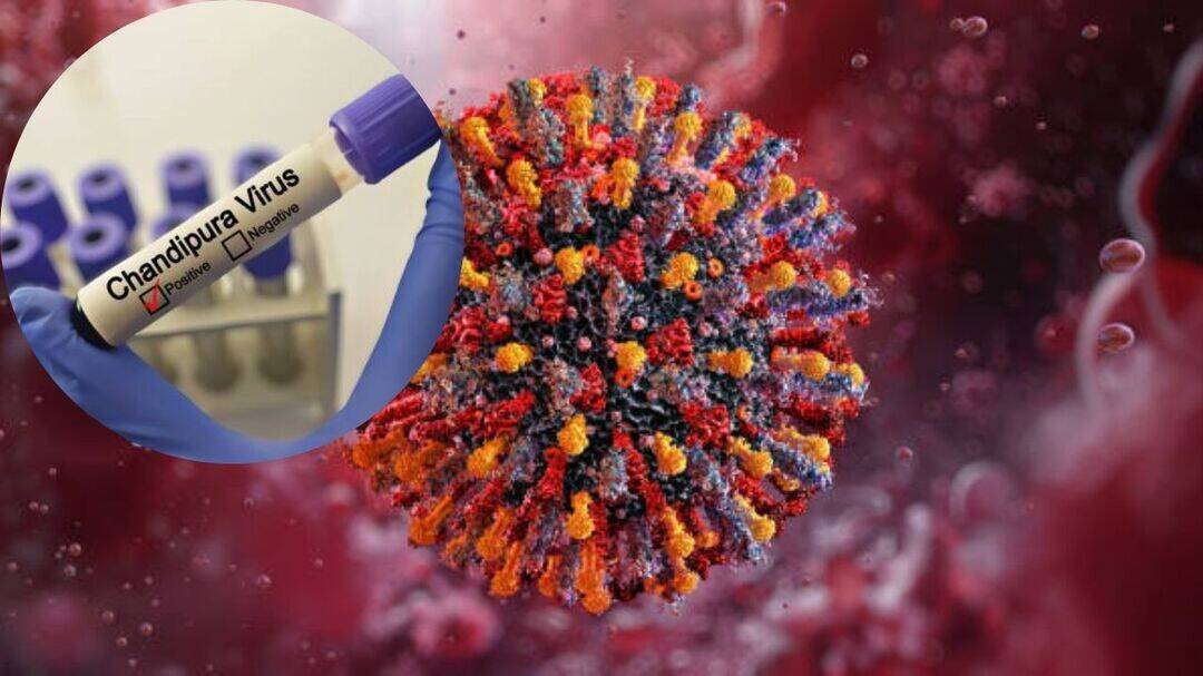 Centre rushes team as Chandipura virus cases rise across Gujarat