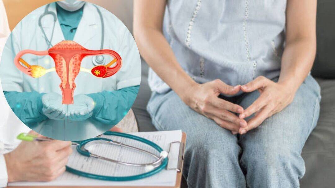Perimenopause symptoms could mask ovarian cancer: Experts