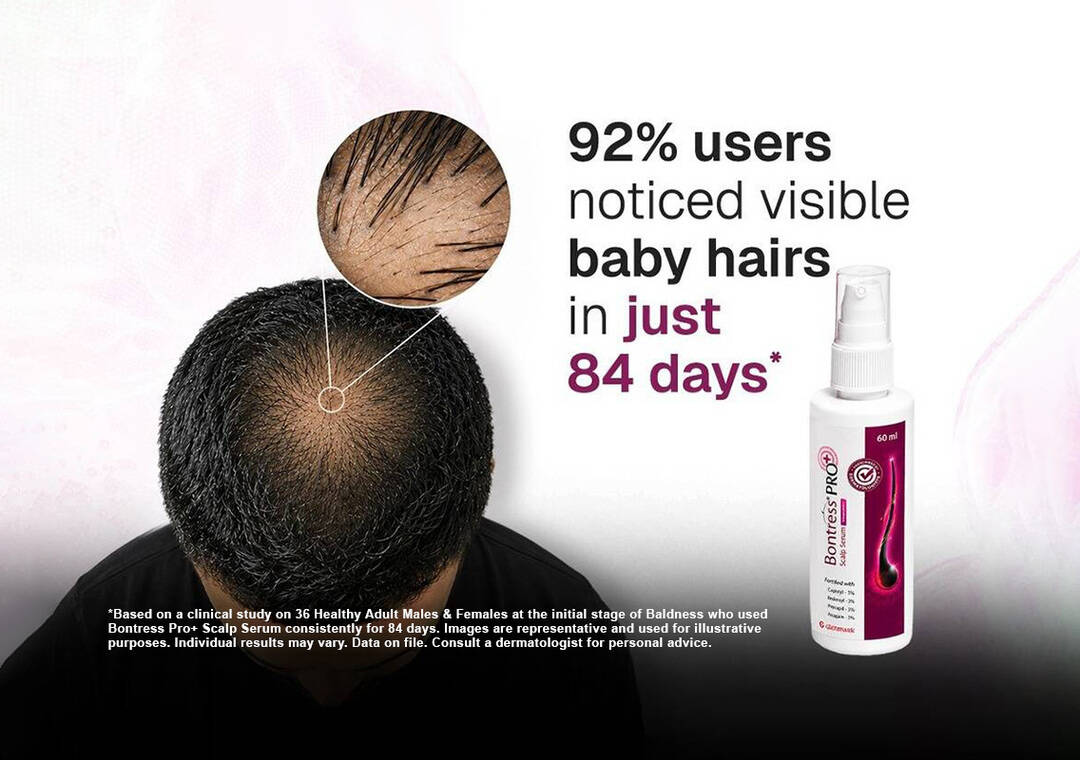 Clinical study shows promising hair regrowth results: Glenmark