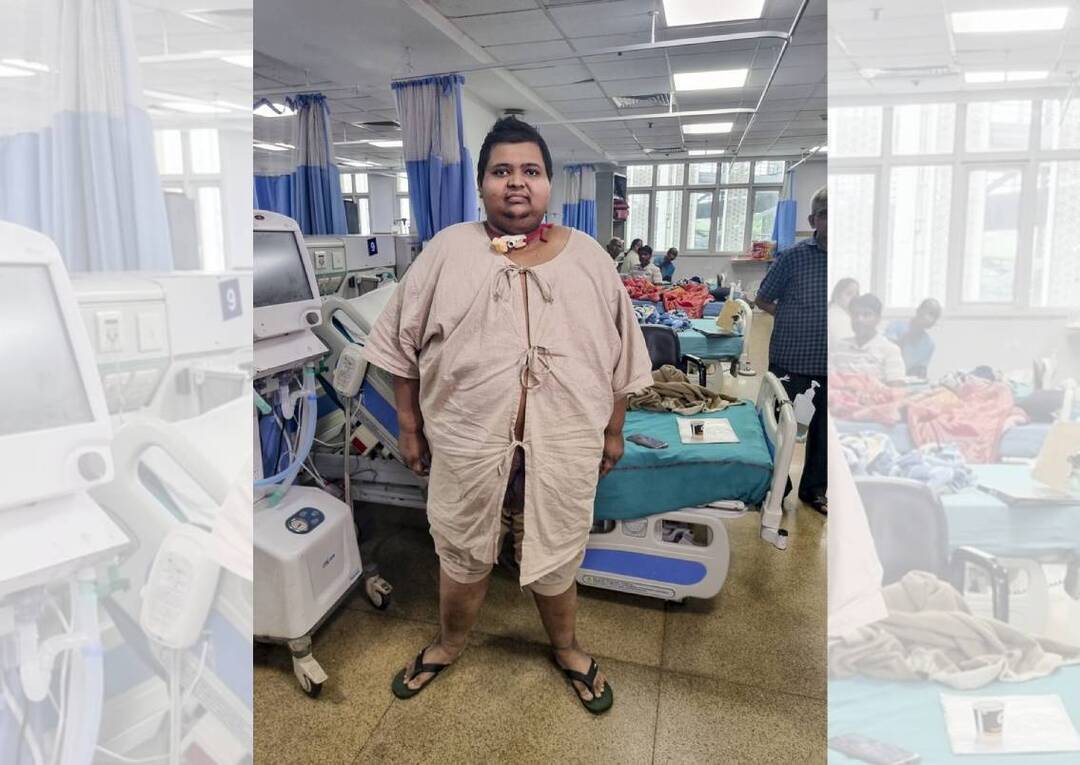 32-yr-old man weighing 209 kg gets another lease of life at AIIMS, loses 49 kg