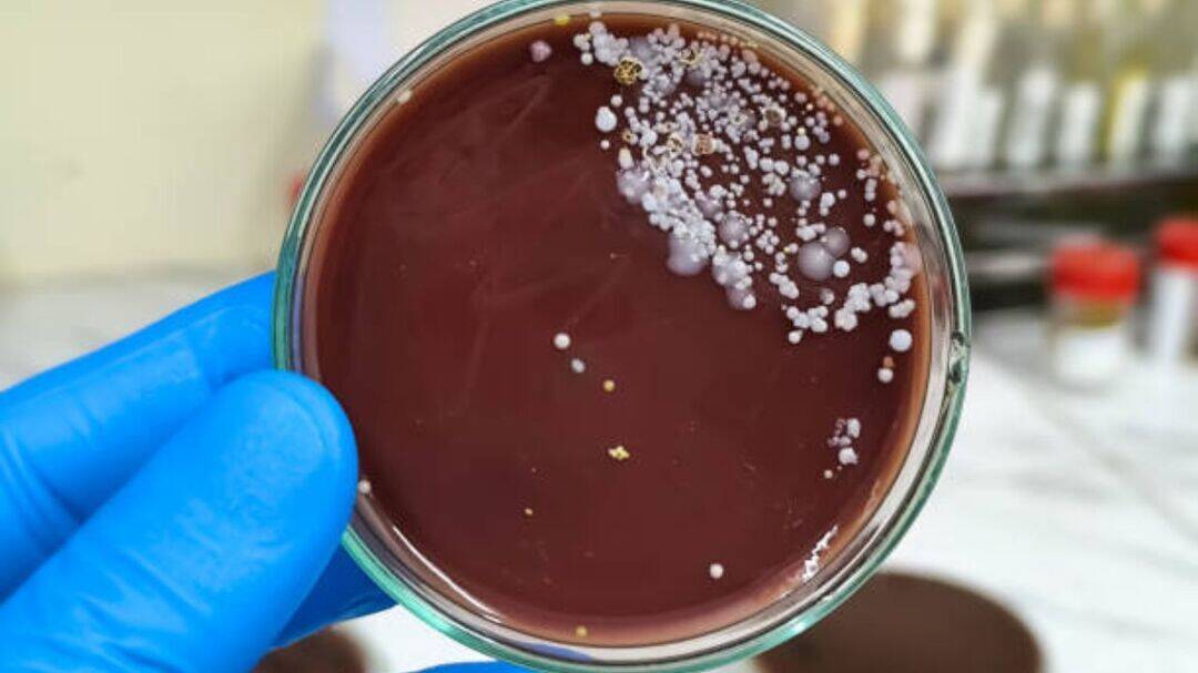 Candida auris cases top 3,400 across the United States