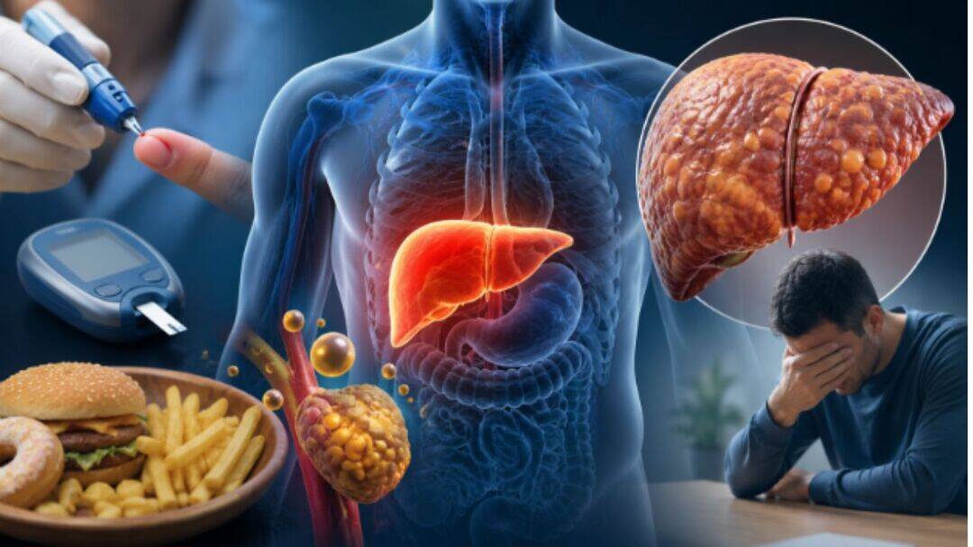 Early signs of liver damage to never ignore if you have diabetes 
