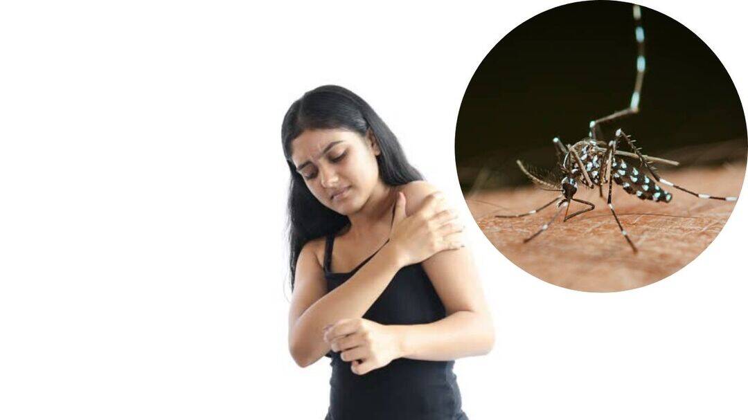 Chikungunya warning: Fever may go, but joint pain can persist