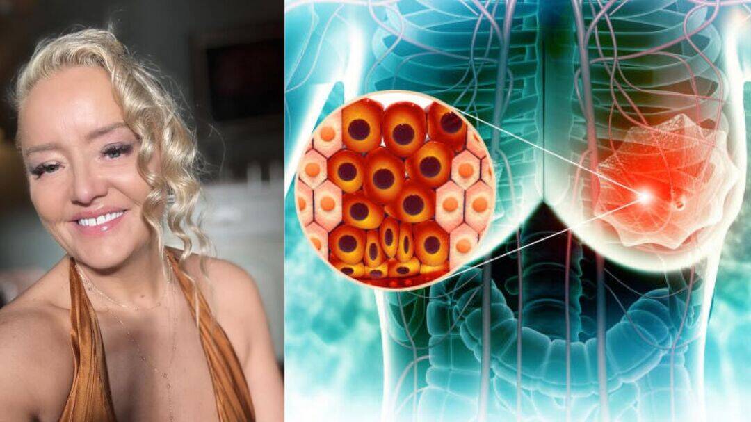 The Office star Lucy Davis reveals stage 4 breast cancer spread