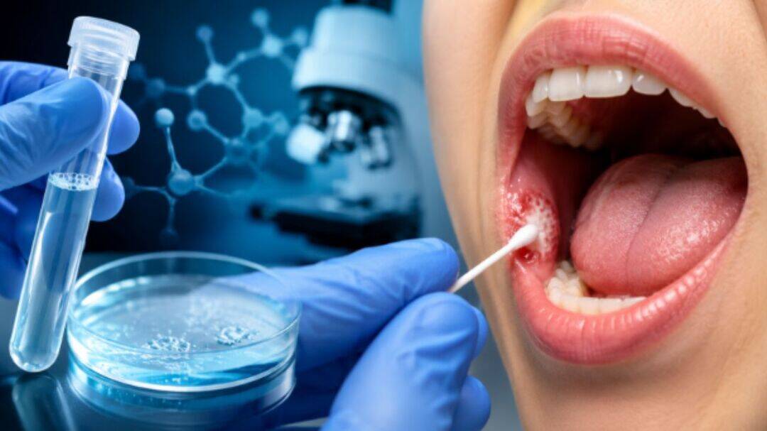 IIT Indore develops non-invasive oral cancer detection method