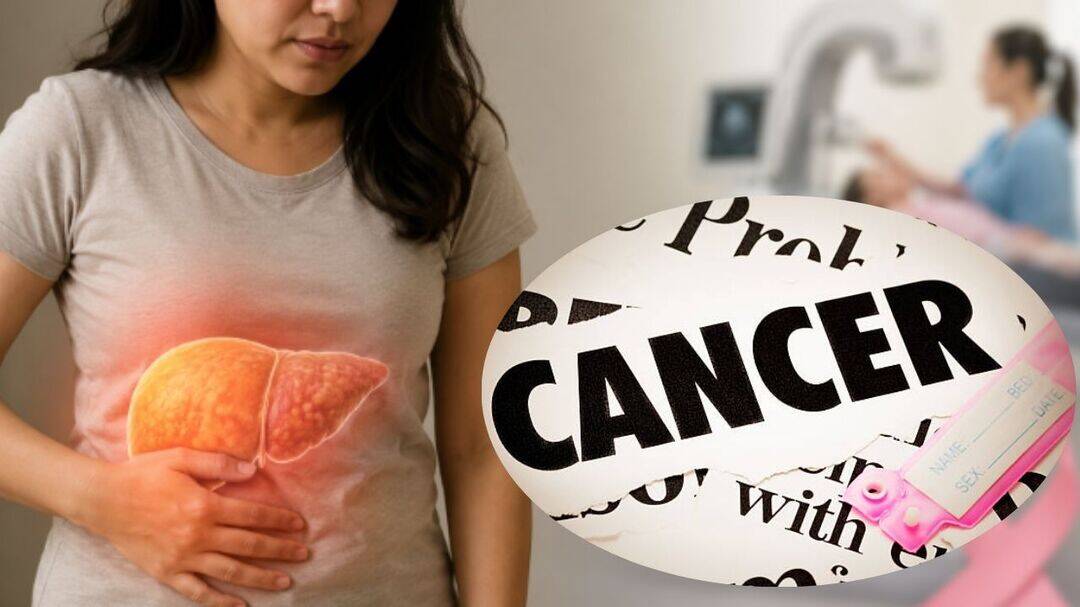 Women with fatty liver should not skip a crucial cancer screening