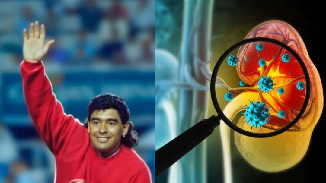 Nephrologist highlights Maradona's kidney issues before his death