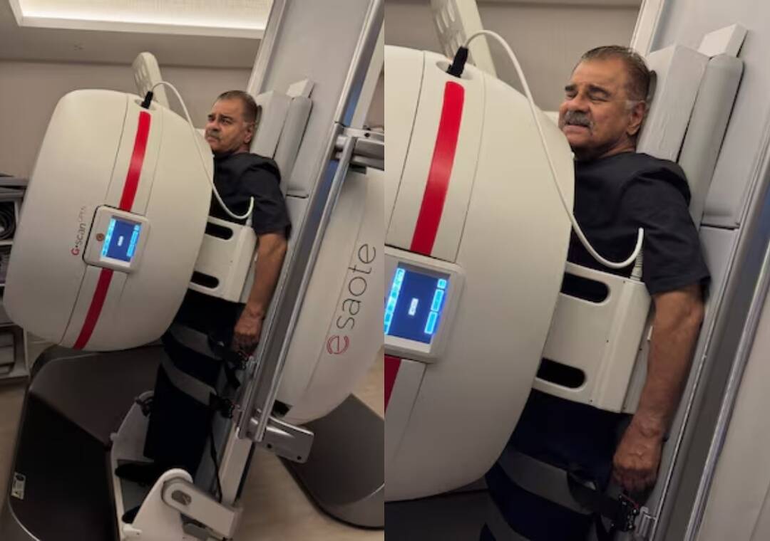 Sharat Saxena shares pics of himself undergoing standing MRI before lumbar spine surgery