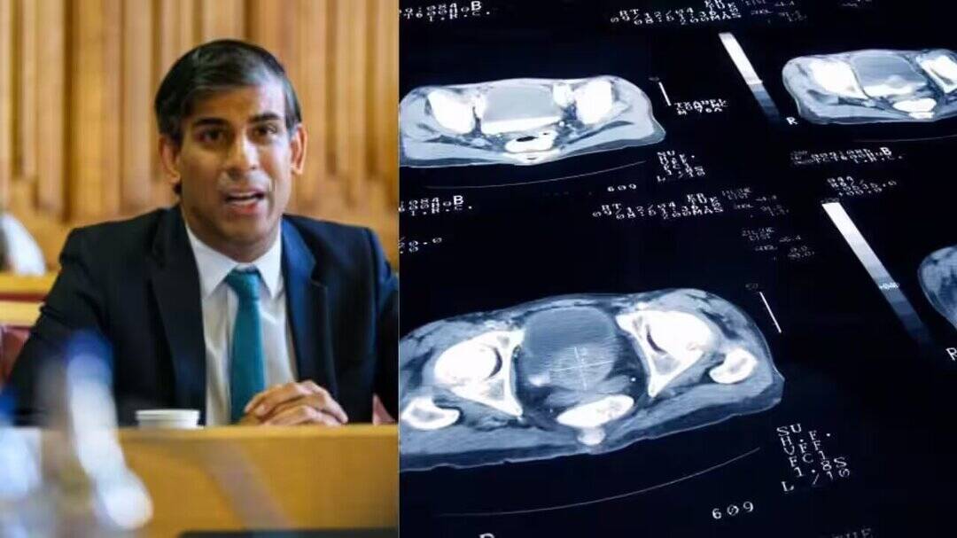 Rishi Sunak calls for prostate cancer screening in high-risk men