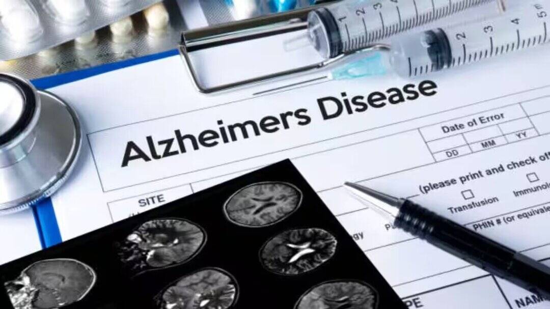 Forgetfulness or Alzheimer’s? Doctor reveals warning signs 