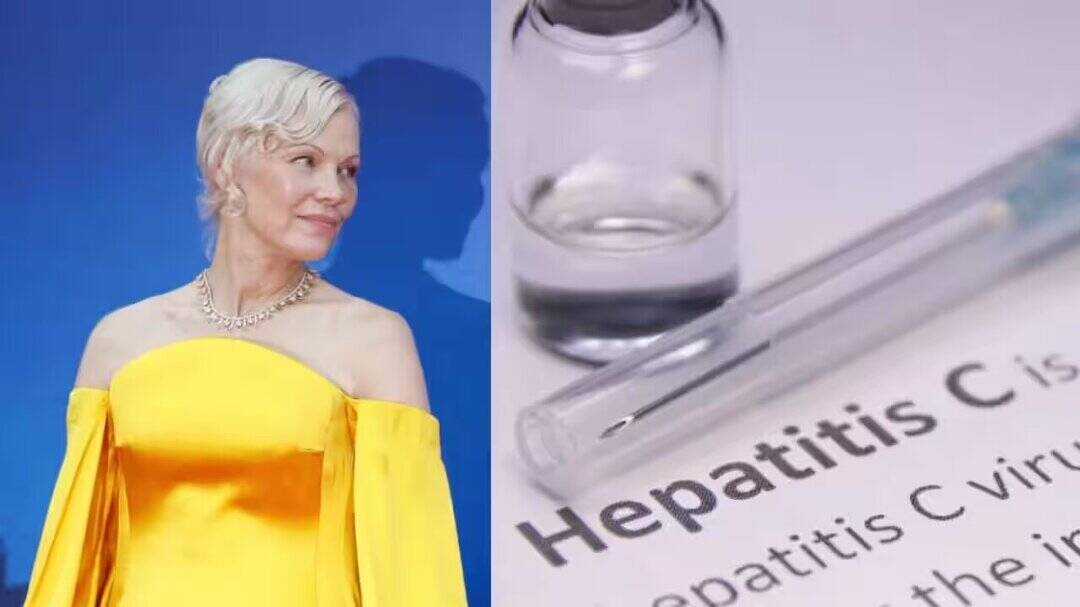'It changed me': Pamela Anderson opens up about Hepatitis C battle