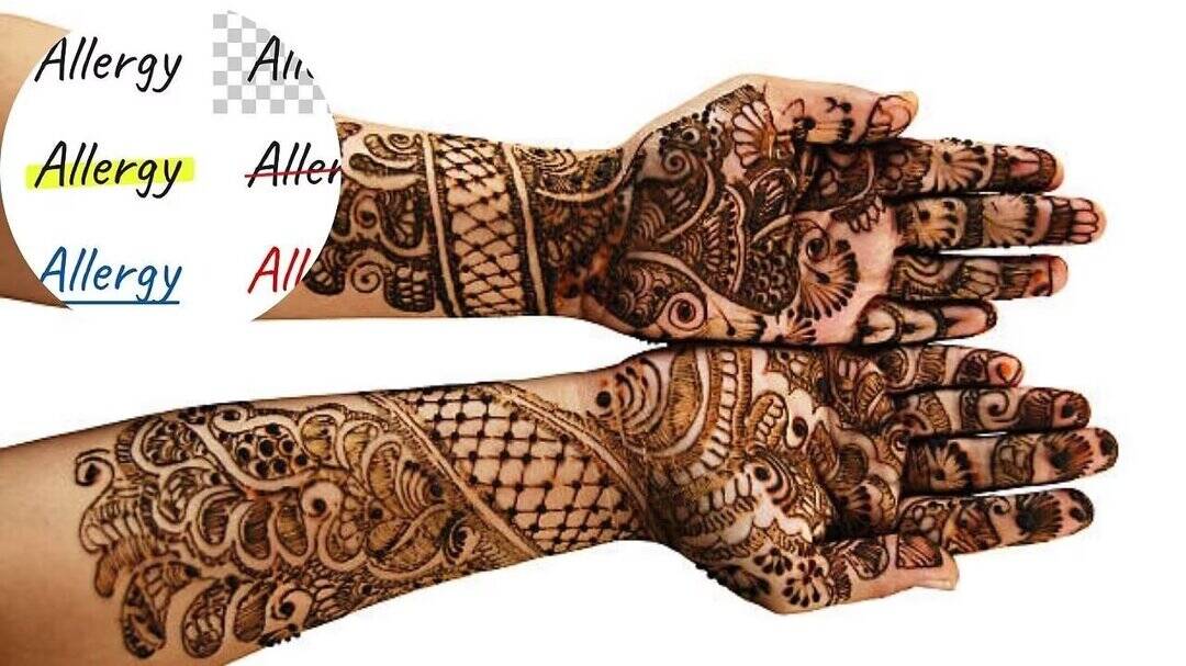 Dermatologists warn black mehendi can cause severe skin burns
