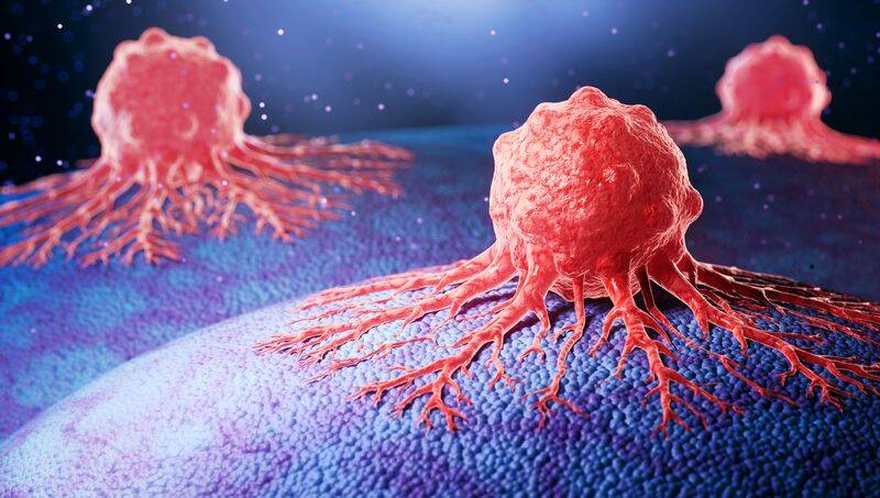 AIIMS-Delhi develops AI-based tool for breast cancer screening