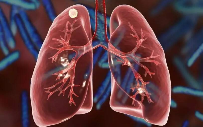 Could morning cough and wheezing signal a lung problem?