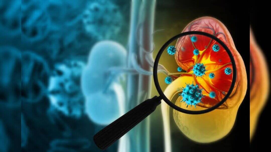 Karnataka kidney disease deaths triple in 10 years