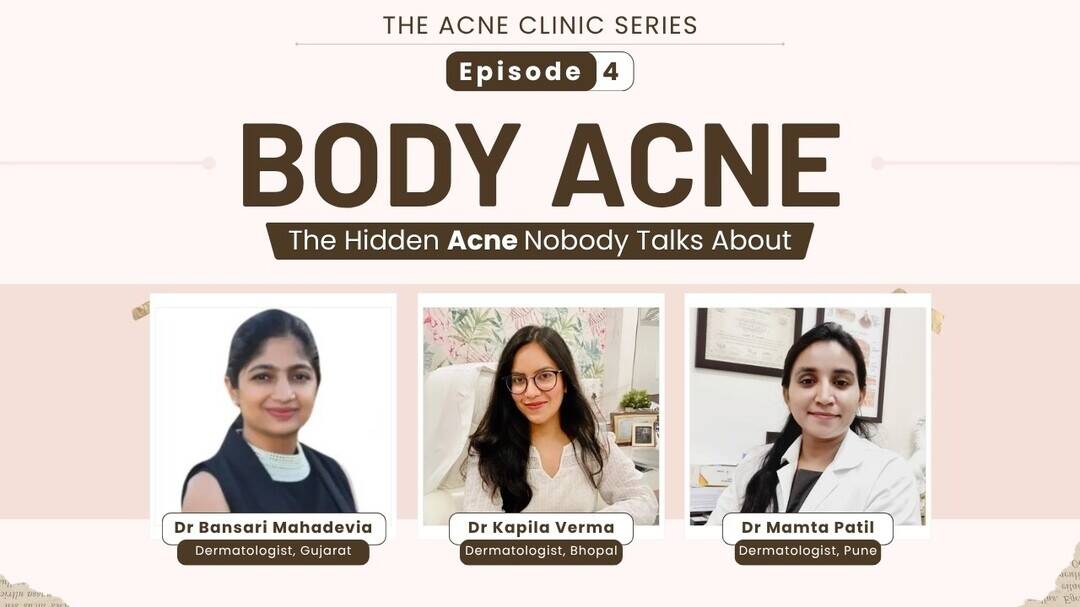 What causes body acne and how can it be managed?