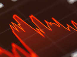 1-for-25 split sends DXST stock crashing pre-market