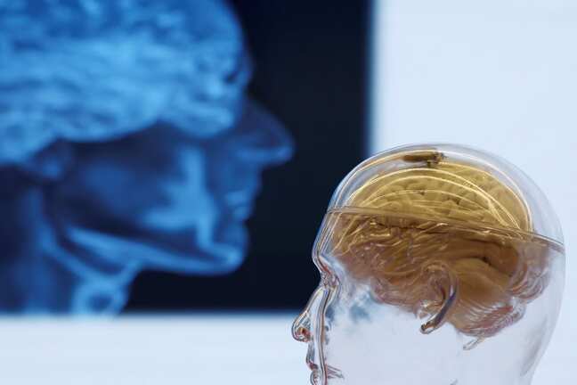 China-backed firm NeuCyber says it's 3 yrs behind Musk's Neuralink