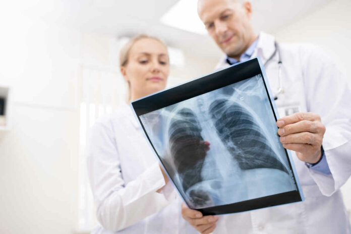 Can lung cancer be healed? 