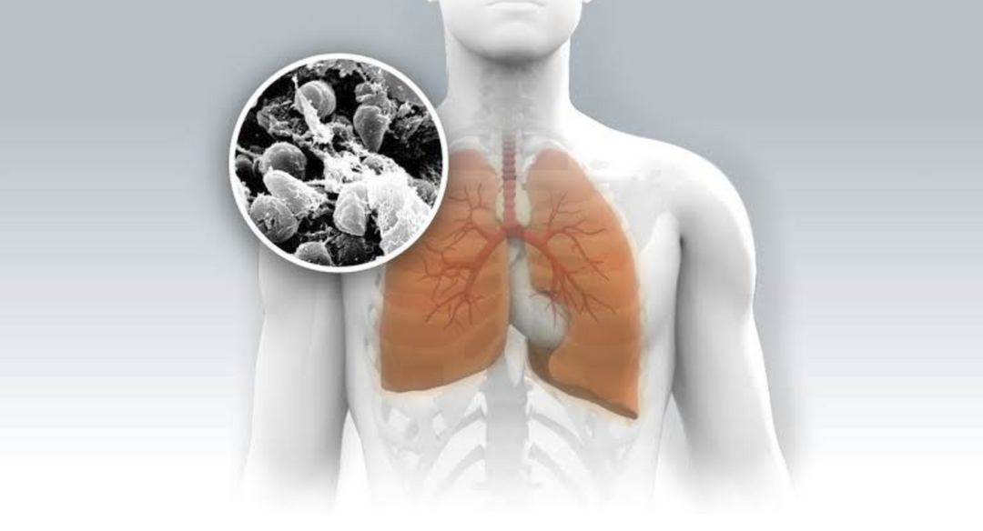 How dangerous is Pneumonic plague and how does it spread?