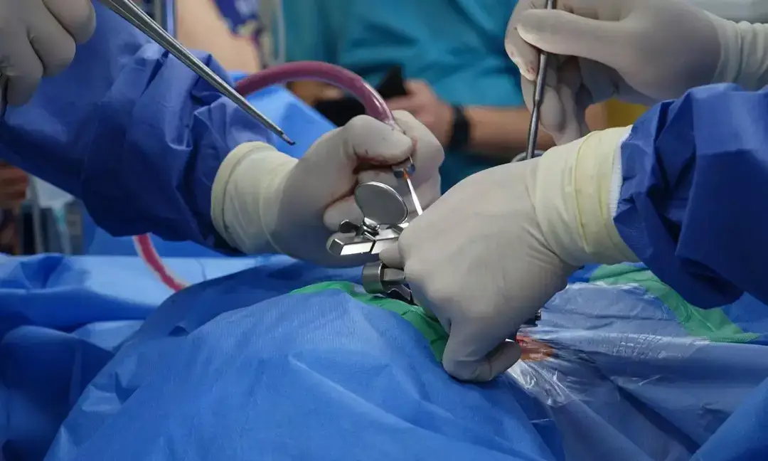 Spinal TB surgery helps 65-year-old walk again in Thane