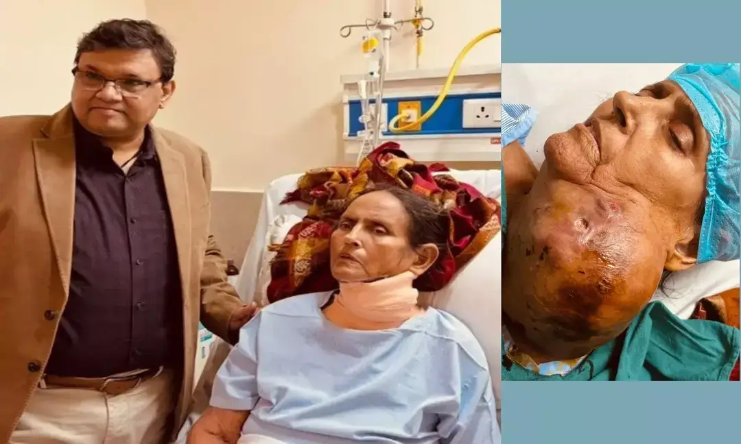 72-year-old woman recovers after critical carotid artery in UP