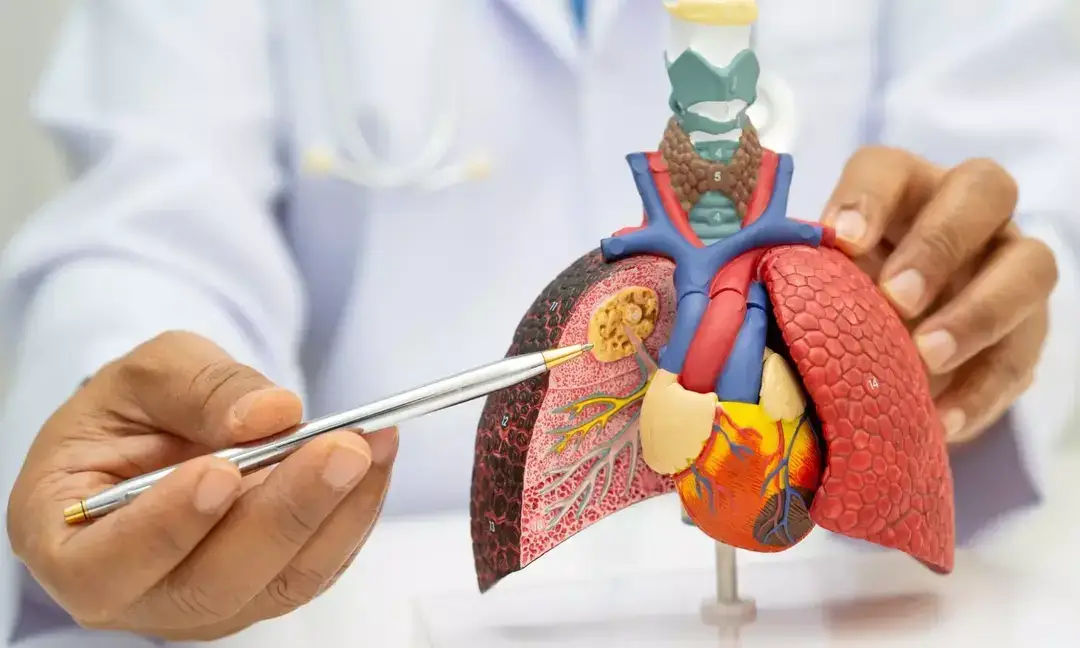 Kerala's 1st liver transplant for propionic acidemia successful