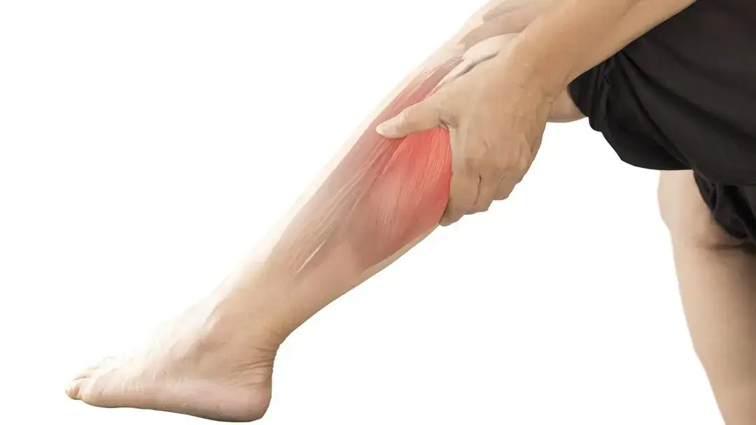 What is charley horse, the condition related to leg pain?