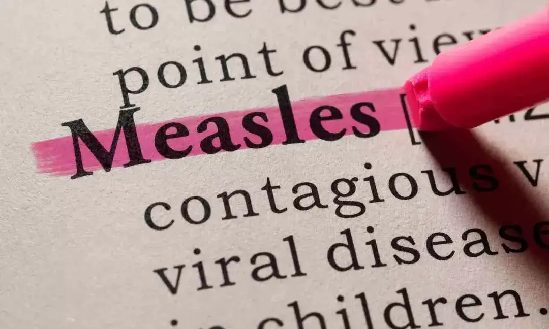 US reports highest measles cases since 1992