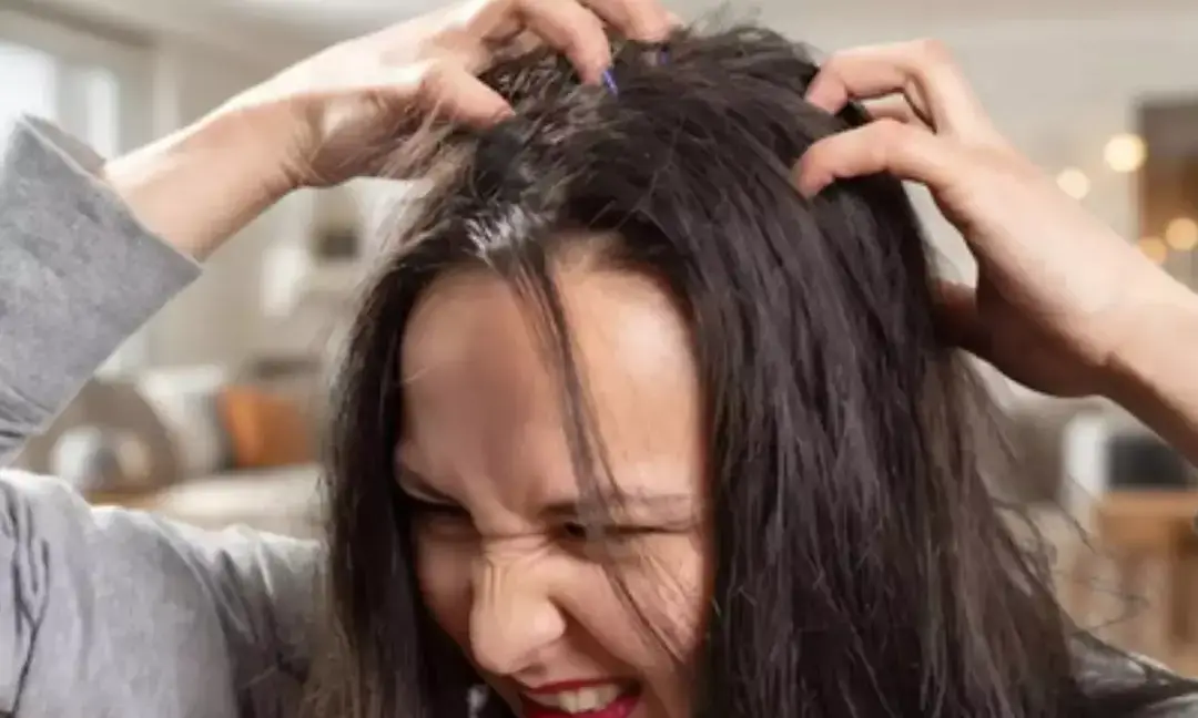 What are some effective natural remedies to eliminate head lice?