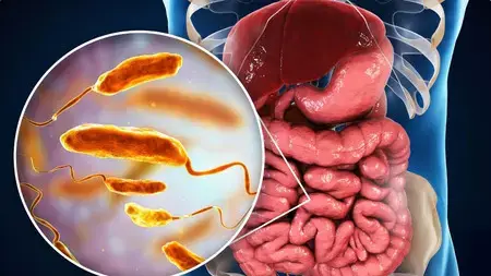 The secret world inside your gut