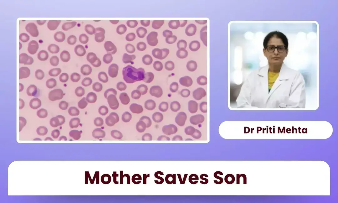 Mother donor saves boy with high-risk leukemia