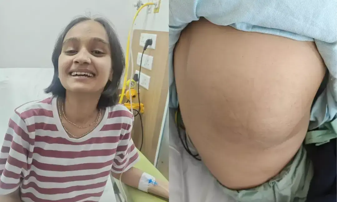 Teen beats rare stage 3 bone cancer after 10-day ICU battle