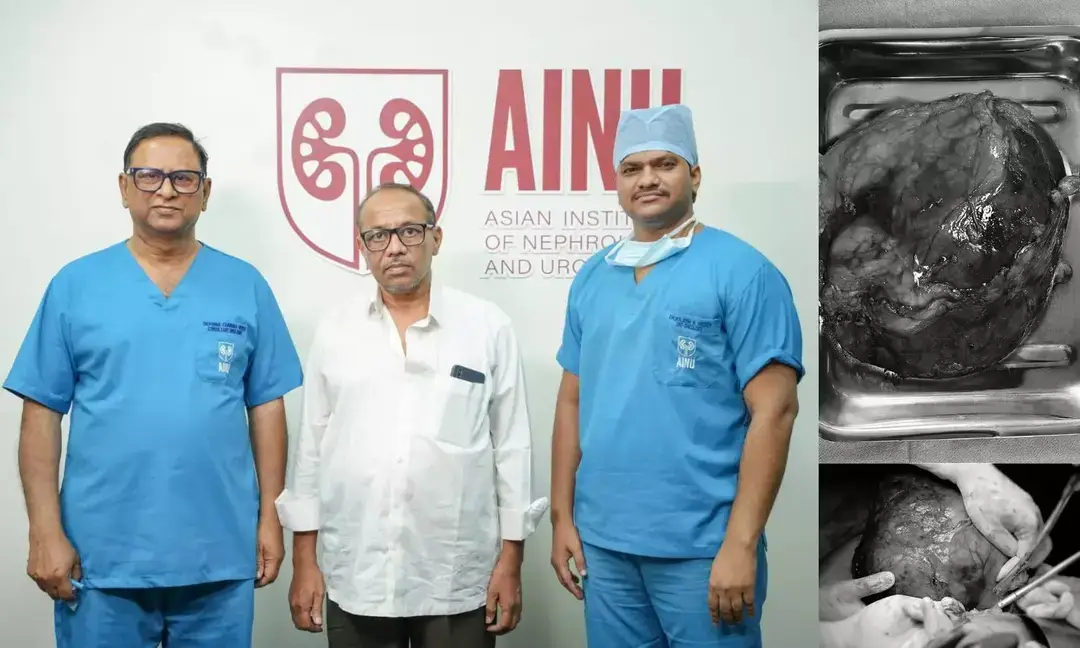 Doctors at AINU successfully remove giant kidney tumour