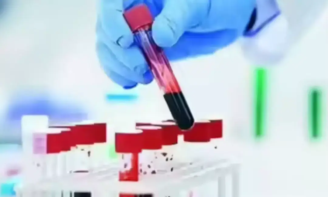 Study identifies blood markers that predict lung cancer 