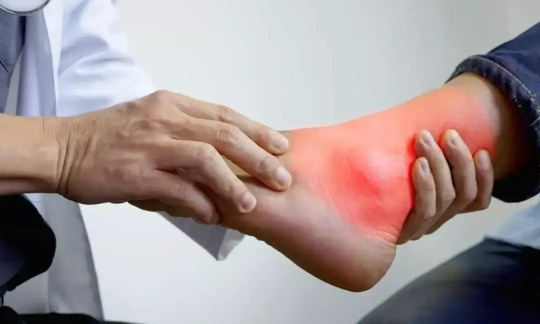 These habits can help control uric acid levels